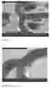 Fig. 04 -  Coating Comprising A Poly(Ethylene Glycol)-Poly(Lactide-Glycolide-Caprolactone) Interpenetrating Network