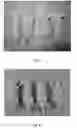 Fig. 09 - COMPOUNDS AND COMPOSITIONS COMPRISING CDK INHIBITORS AND METHODS FOR TREATING  CANCER