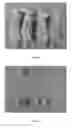 Fig. 10 - COMPOUNDS AND COMPOSITIONS COMPRISING CDK INHIBITORS AND METHODS FOR TREATING  CANCER