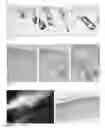 Fig. 02 - Methods for generating new hair follicles, treating baldness, and hair removal
