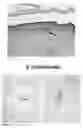 Fig. 03 - Methods for generating new hair follicles, treating baldness, and hair removal