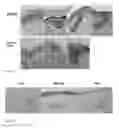 Fig. 05 - Methods for generating new hair follicles, treating baldness, and hair removal