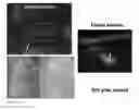 Fig. 09 - Methods for generating new hair follicles, treating baldness, and hair removal
