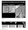 Fig. 10 - Methods for generating new hair follicles, treating baldness, and hair removal
