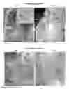 Fig. 12 - Methods for generating new hair follicles, treating baldness, and hair removal