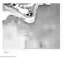 Fig. 14 - Methods for generating new hair follicles, treating baldness, and hair removal