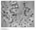 Fig. 41 - Methods for generating new hair follicles, treating baldness, and hair removal