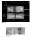 Fig. 42 - Methods for generating new hair follicles, treating baldness, and hair removal