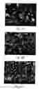 Fig. 04 - Tolbutamide Particle And Preparing Method Thereof And Method Of Reducing A Blood Glucose