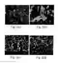 Fig. 03 - Acetazolamide Microparticle And Its Preparation Method And Use