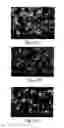 Fig. 06 - Acetazolamide Microparticle And Its Preparation Method And Use