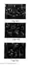 Fig. 08 - Acetazolamide Microparticle And Its Preparation Method And Use