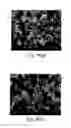 Fig. 10 - Acetazolamide Microparticle And Its Preparation Method And Use