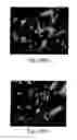 Fig. 11 - Acetazolamide Microparticle And Its Preparation Method And Use