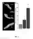 Fig. 13 - METHODS OF MAKING AND USING THREE-DIMENSIONAL EXTRACELLULAR MATRICES
