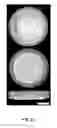 Fig. 24 - METHODS OF MAKING AND USING THREE-DIMENSIONAL EXTRACELLULAR MATRICES