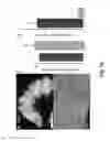 Fig. 32 - METHODS OF MAKING AND USING THREE-DIMENSIONAL EXTRACELLULAR MATRICES