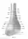 Fig. 09 - ANIMATED ARTIFICIAL FLOWER