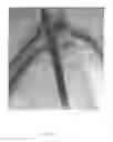 Fig. 06 - Methods of making a reinforced composite and reinforced composite products