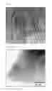 Fig. 07 - NEGATIVE ACTIVE MATERIAL AND LITHIUM SECONDARY BATTERY WITH THE SAME, AND METHOD FOR MANUFACTURING THE LITHIUM SECONDARY BATTERY