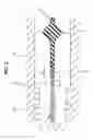 Fig. 03 - Seal structure for fuel cell and method for producing same