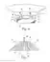Fig. 04 - Orthodontic bracket