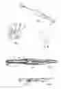 Fig. 02 - Dental system for trans-illumination of teeth