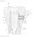 Fig. 05 - DENTAL IMPLANT