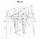Fig. 07 - Dental implant
