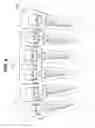 Fig. 10 - Dental implant