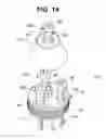Fig. 14 - Dental implant