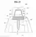 Fig. 18 - Dental implant
