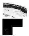 Fig. 03 - Method of processing allograft skin for transplantation, and cryopreserved allograft skin produced thereby