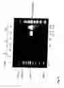 Fig. 16 - Method and kit for detection of microorganism