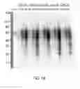 Fig. 17 - Expression vector for producing protein derived from foreign gene in large quantity using animal cells, and use thereof