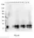 Fig. 26 - Expression vector for producing protein derived from foreign gene in large quantity using animal cells, and use thereof