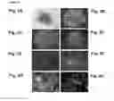 Fig. 03 - Neural progenitor cells derived from embryonic stem cells