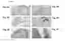 Fig. 05 - Neural progenitor cells derived from embryonic stem cells
