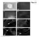 Fig. 07 - Neural progenitor cells derived from embryonic stem cells