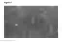 Fig. 08 - Neural progenitor cells derived from embryonic stem cells