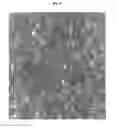 Fig. 09 - Neural progenitor cells derived from embryonic stem cells