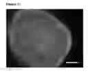 Fig. 12 - Neural progenitor cells derived from embryonic stem cells