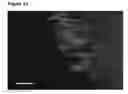 Fig. 14 - Neural progenitor cells derived from embryonic stem cells