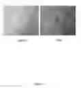 Fig. 17 - Monclonal antibodies, hybridomas and methods for use