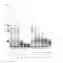 Fig. 10 - Bacteriophage adhesion proteins