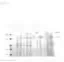 Fig. 12 - Bacteriophage adhesion proteins