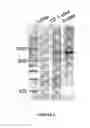 Fig. 03 - PCR-BASED METHOD OF SYNTHESIZING A NUCLEIC ACID MOLECULE