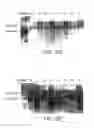 Fig. 06 - Glycosylation engineering of antibodies for improving antibody-dependent cellular cytotoxicity