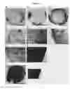 Fig. 20 - Tubular bioreactor system for use in bone and cartilage tissue engineering