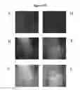 Fig. 09 - Generation of neural stem cells from undifferentiated human embryonic stem cells